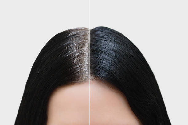 Before and after comparison of hair color treatment on a person with a neutral background.